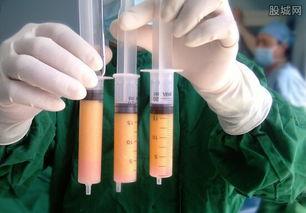 抽脂手术视频全过程,从术前准备到术后恢复